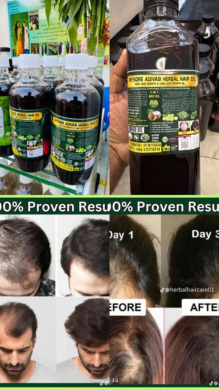 Adivasi Secret™ Orignal Herbal Hair Oil 100ml