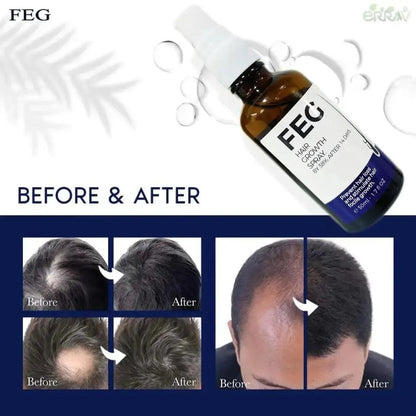 FEG PLUS™ Fast Hair Growth Spray + FREE Derma Roller