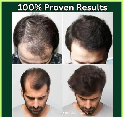 Adivasi Secret™ Orignal Herbal Hair Oil 100ml